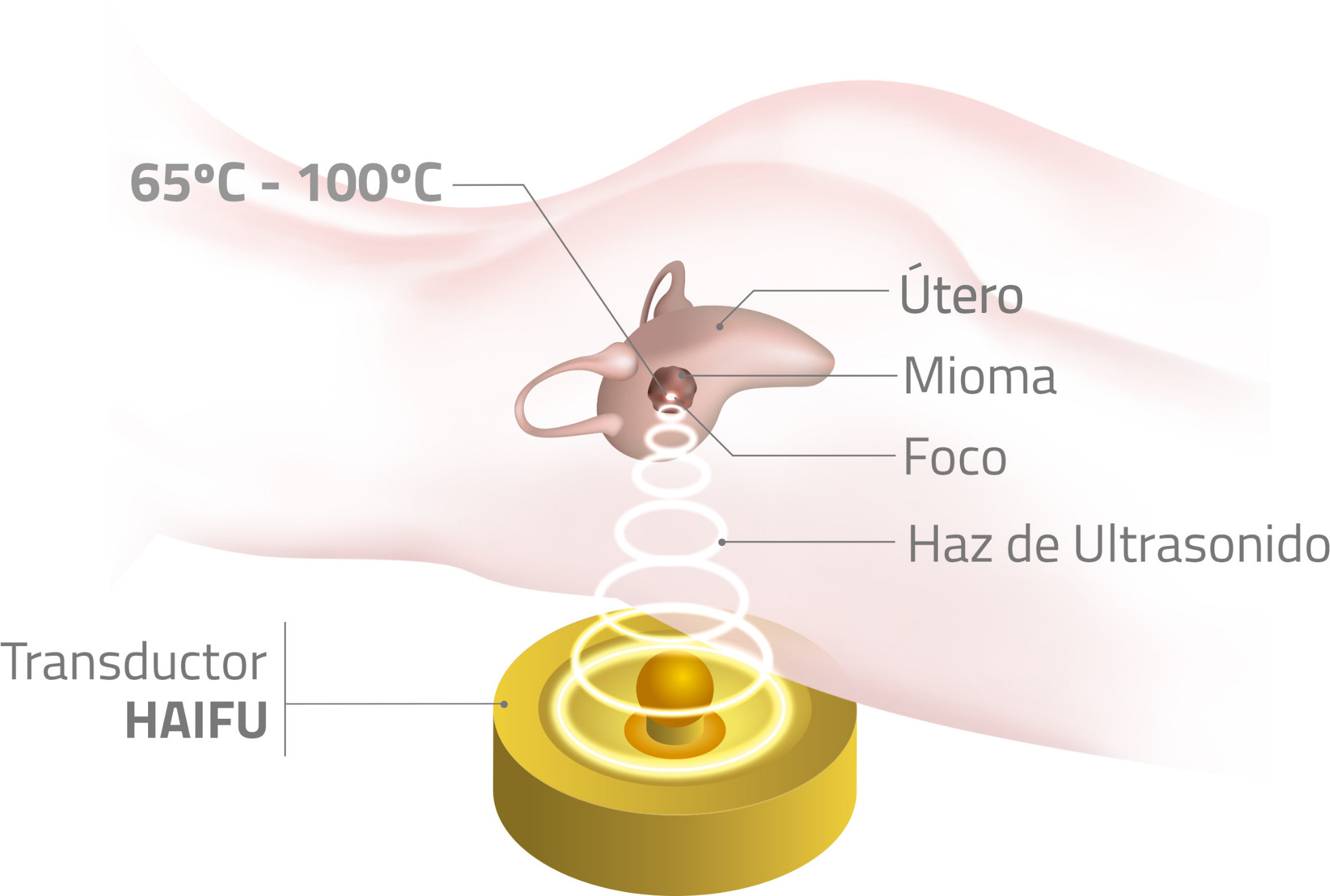 Transductor